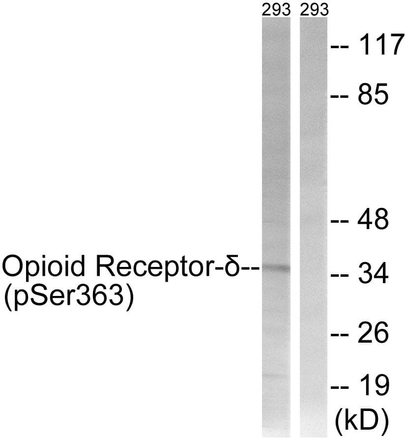 OPRD1 / Delta Opioid Receptor Antibody (phospho-Ser363)