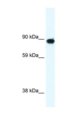 GRM6 / MGLUR6 Antibody (aa700-749)