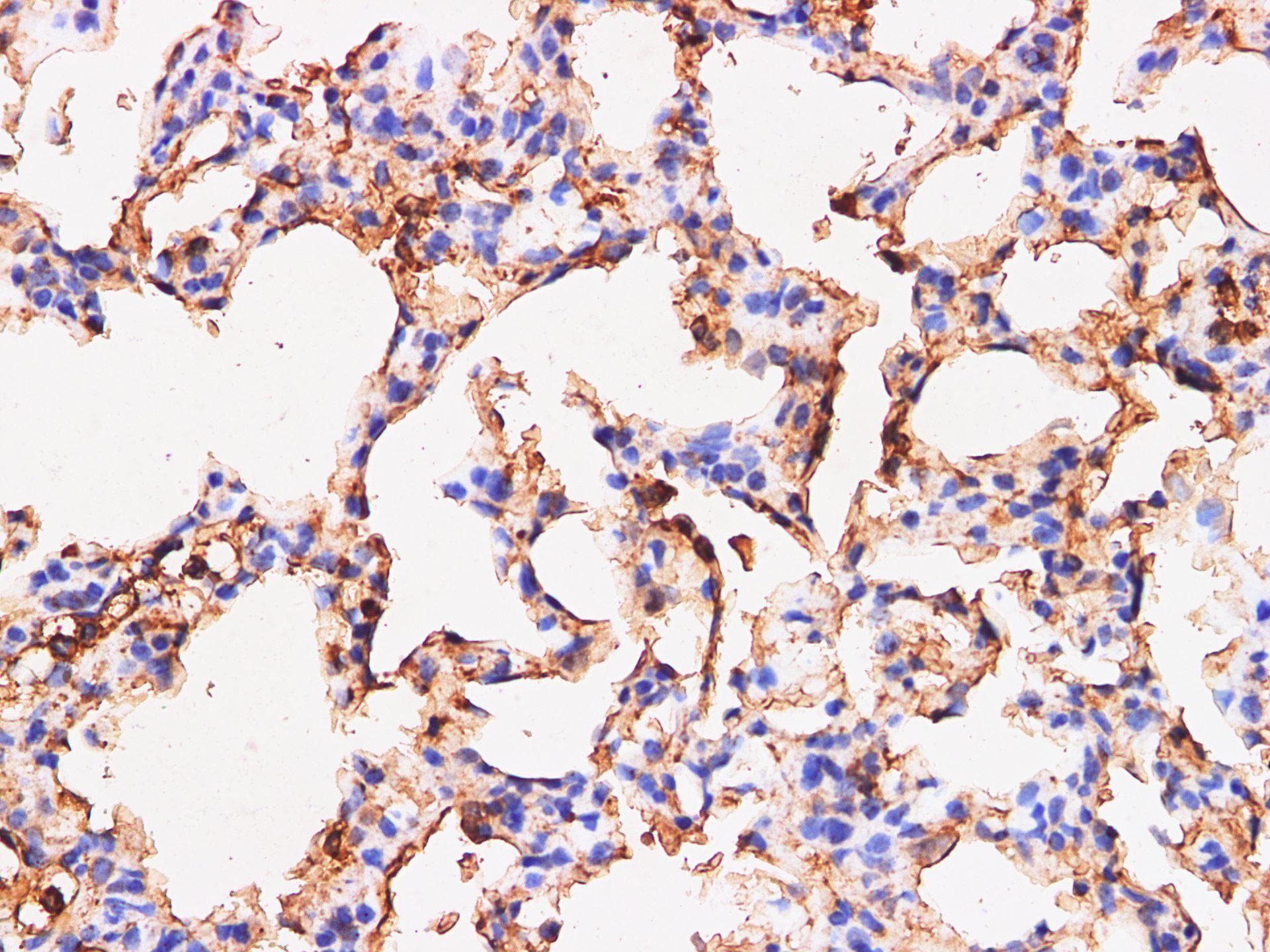 Polyclonal Rabbit anti-Rat S100A9 / MRP14 Antibody (IHC, WB)
