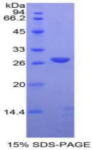 Rat ADAM10 Protein (Recombinant His)