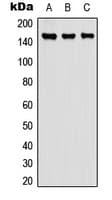 CPD Antibody (Internal)