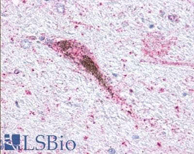 PathPlus™ Polyclonal Rabbit anti-Human GPR34 Antibody (Cytoplasmic Domain, IHC)