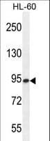 Polyclonal Rabbit anti-Human ENGASE Antibody (aa326-354, IHC, WB)