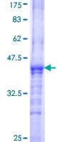 Human ST8SIA2 / STX Protein (Recombinant GST, N-terminus)
