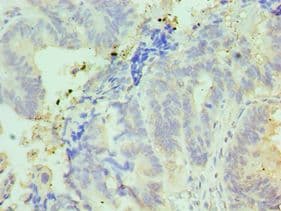 Polyclonal Rabbit anti-Human IFT57 / HIPPI Antibody (aa170-429, IHC, WB)