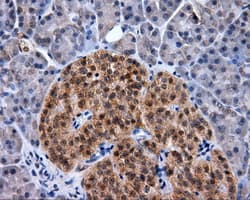 NPR3 Antibody (clone OTI4A1)