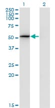 PSMD4 / RPN10 Antibody (clone 3C9)