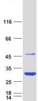 Human N6AMT2 Protein (Recombinant Myc-DDK (Flag))