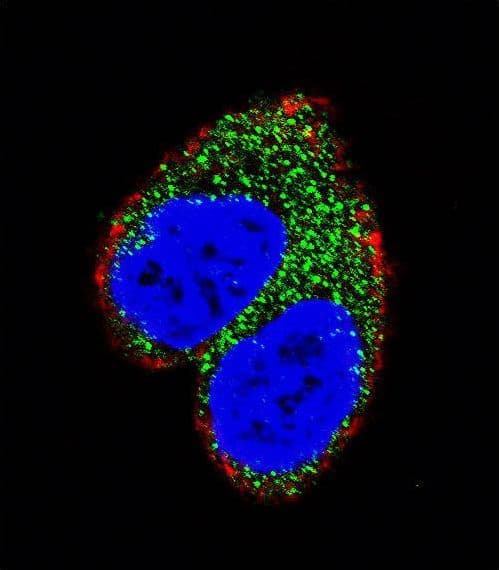 AIM2 Antibody (aa4-32)