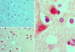 AGAP2 / PIKE Antibody (aa450-500)