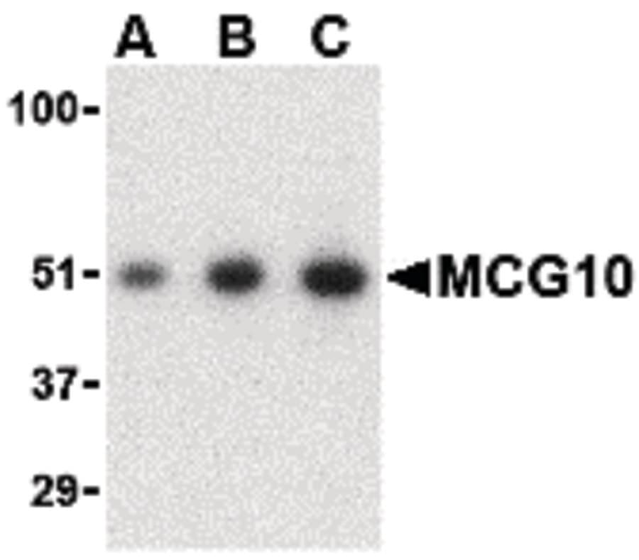 IHC-plus™ PCBP4 Antibody