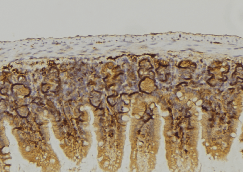 LRP6 Antibody