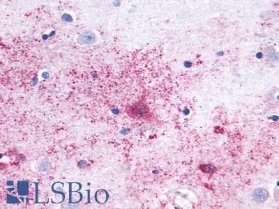 PathPlus™ MAS1 / MAS Antibody (Cytoplasmic Domain)