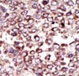 RPN2 / Ribophorin II Antibody (aa16-46)