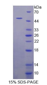 Mouse RNF4 Protein (Recombinant His-GST, N-terminus)