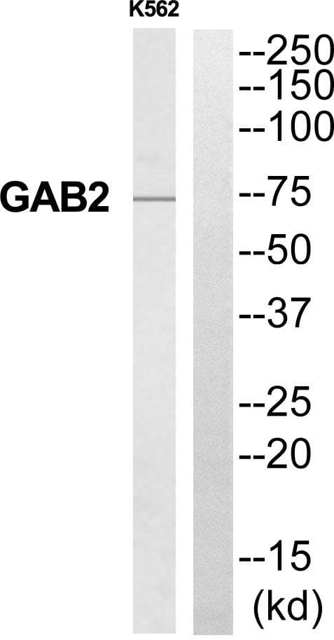 Polyclonal Rabbit anti-Human GAB2 Antibody (WB)