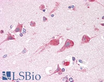 IHC-plus™ ARSA / Arylsulfatase A Antibody (aa431-442)
