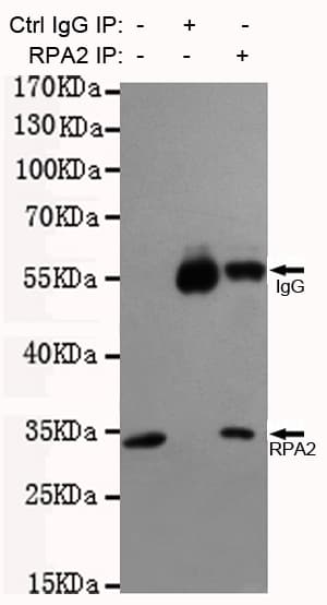 RPA2 / RFA2 / RPA34 Antibody