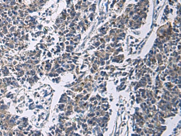 SLC30A3 / ZNT3 Antibody