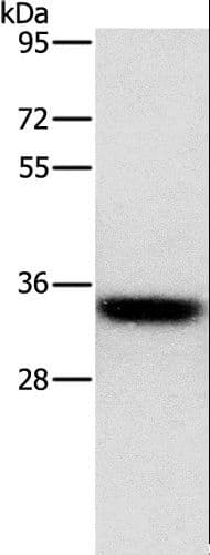 HOXB13 Antibody