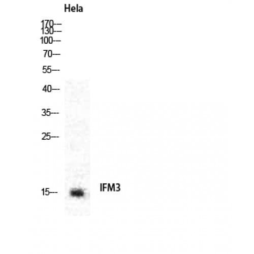 Polyclonal Rabbit anti-Human Fragilis / IFITM3 Antibody (10-90 aa, N-terminal, IF, WB)
