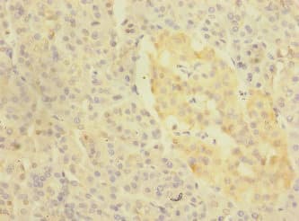 Polyclonal Rabbit anti-Human KREMEN1 / KREMEN-1 Antibody (IHC)