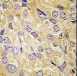 Polyclonal Rabbit anti-Human FZD1 / Frizzled 1 Antibody (aa367-396, IHC, WB)