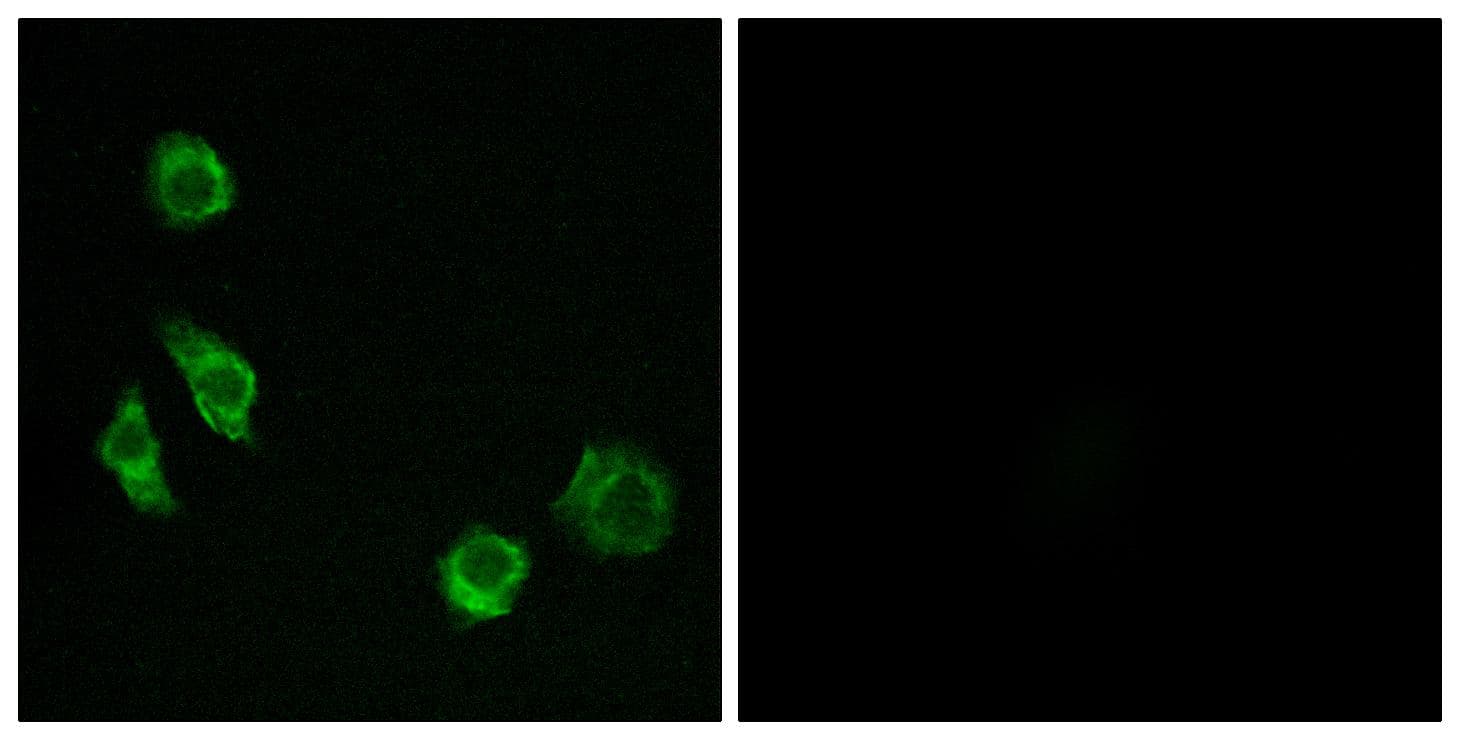GPRC5D Antibody