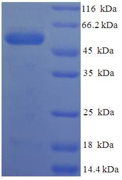Human PRSS23 Protein (Recombinant His-SUMO)