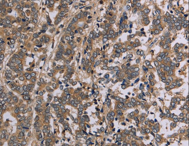 AATK / AATYK Antibody