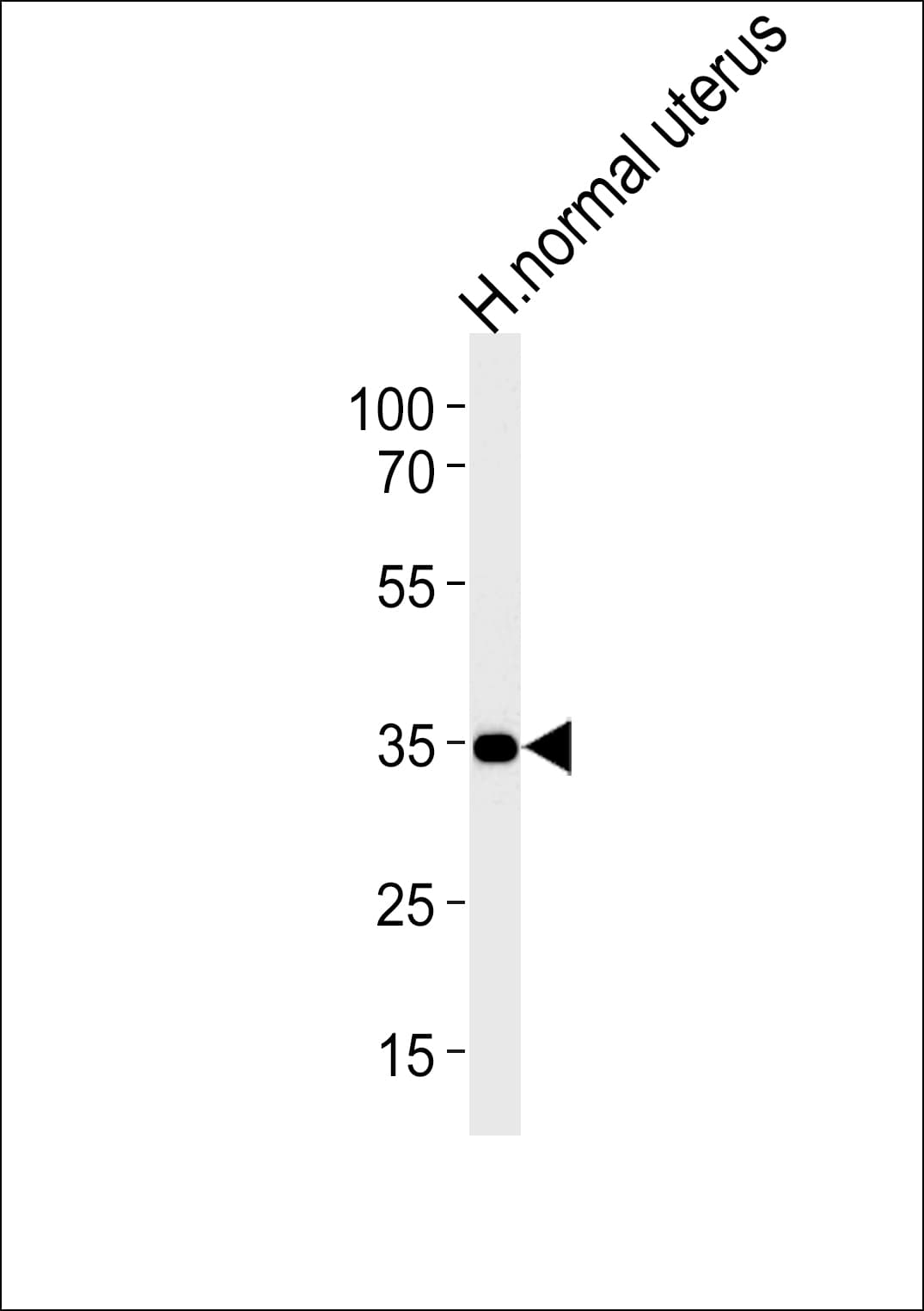Polyclonal Rabbit anti-Human ERG-1 / CUZD1 Antibody (aa579-607, IHC, IF, WB)