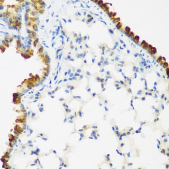 Polyclonal Rabbit anti-Human LRP5 Antibody (aa1000-1250, IHC, WB)