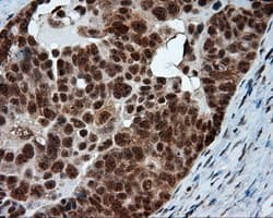 NPR3 Antibody (clone OTI4C3)