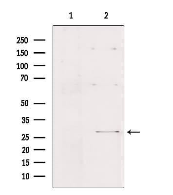 FMR1NB Antibody