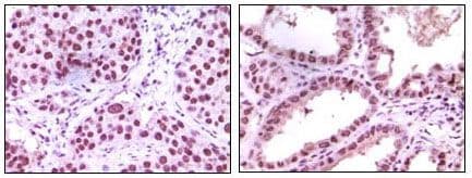 KDM1A / LSD1 Antibody (clone 1B2E5)