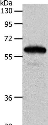 Polyclonal Rabbit anti-Human INA / Alpha Internexin Antibody (IHC, WB)