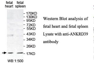 ANKRD39 Antibody (aa2-183)