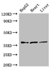 ELOVL4 Antibody