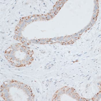 EGFR Antibody
