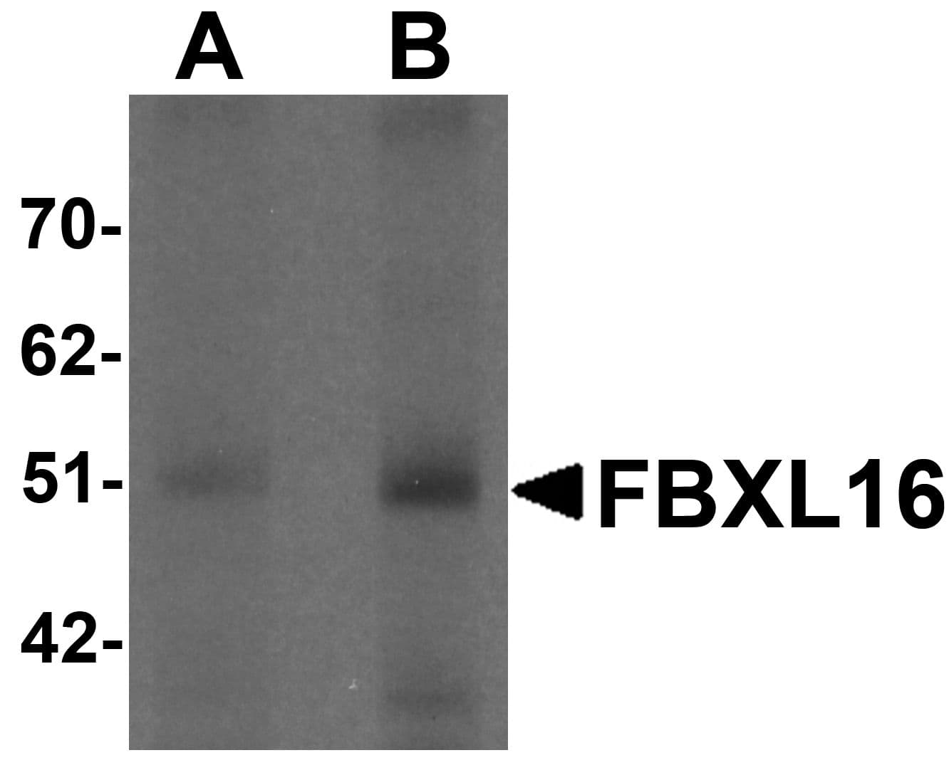 IHC-plus™ FBXL16 Antibody