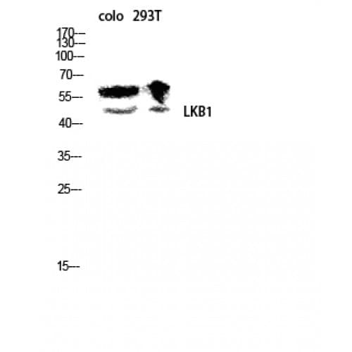 Polyclonal Rabbit anti-Human STK11 / LKB1 Antibody (370-450 aa, IHC, IF, WB)