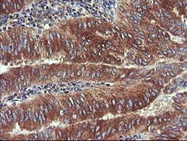 UBE2J1 Antibody (clone OTI1F6)