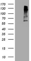 MAGEA3 Antibody (clone OTI2E11)