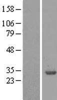 YWHAB / 14-3-3 Beta Protein (Over-Expression Lysate Myc-DDK (Flag))