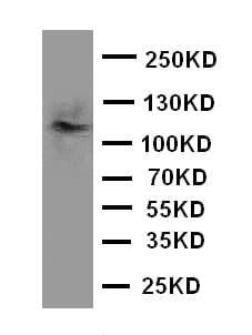 CD45 / LCA Antibody (aa1209-1227)