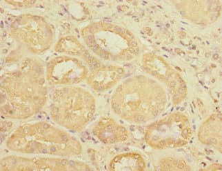 UPK3A / UPK3 / Uroplakin III Antibody