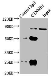 IHC-plus™ CTNNB1 / Beta Catenin Antibody