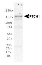 PTCH1 / Patched 1 Antibody (DY650)