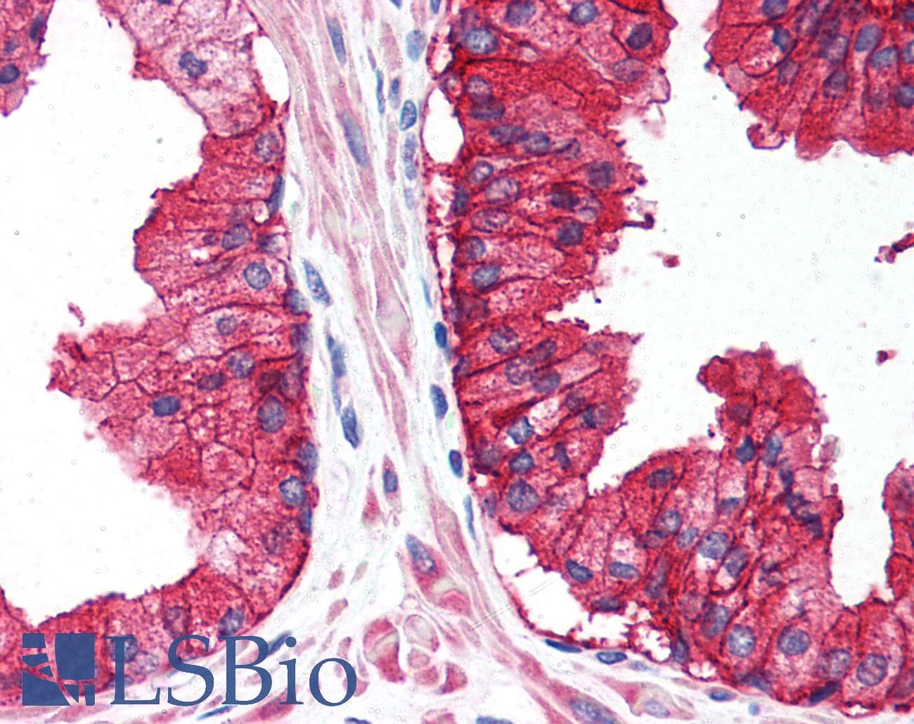 PathPlus™ CD38 Antibody (Internal)