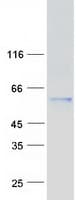 Human KPNA3 / Importin Alpha 4 Protein (Recombinant Myc-DDK (Flag))
